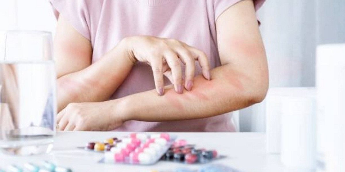 Allergy Treatment Market Trends: Personalized Medicine and Immunotherapy Lead the Way