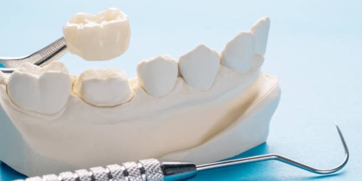 Complete Solution for Damaged Teeth: Dental crown in Islamabad
