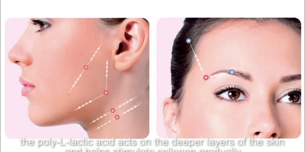 Achieve a Youthful Look with Silhouette Soft Thread Lift in Riyadh