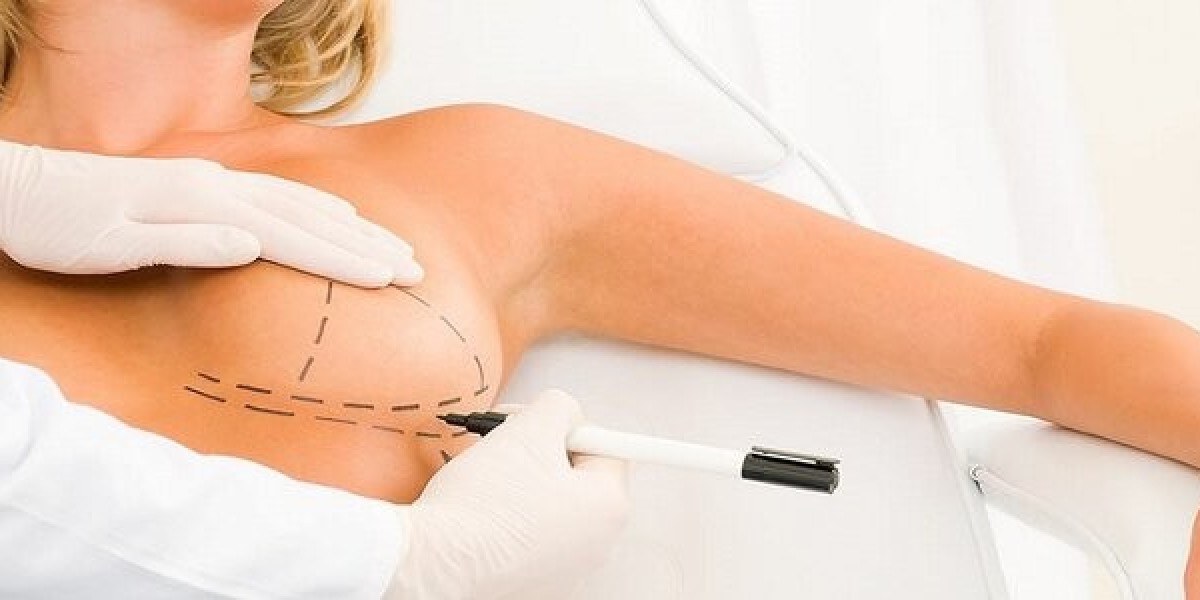 How Breast Lift Surgery Restores Youthful Perkiness in Riyadh