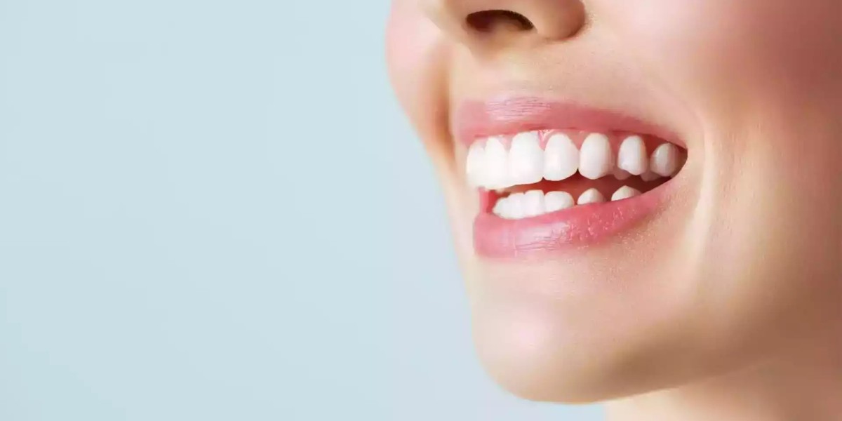 Is Hollywood Smile design reversible?