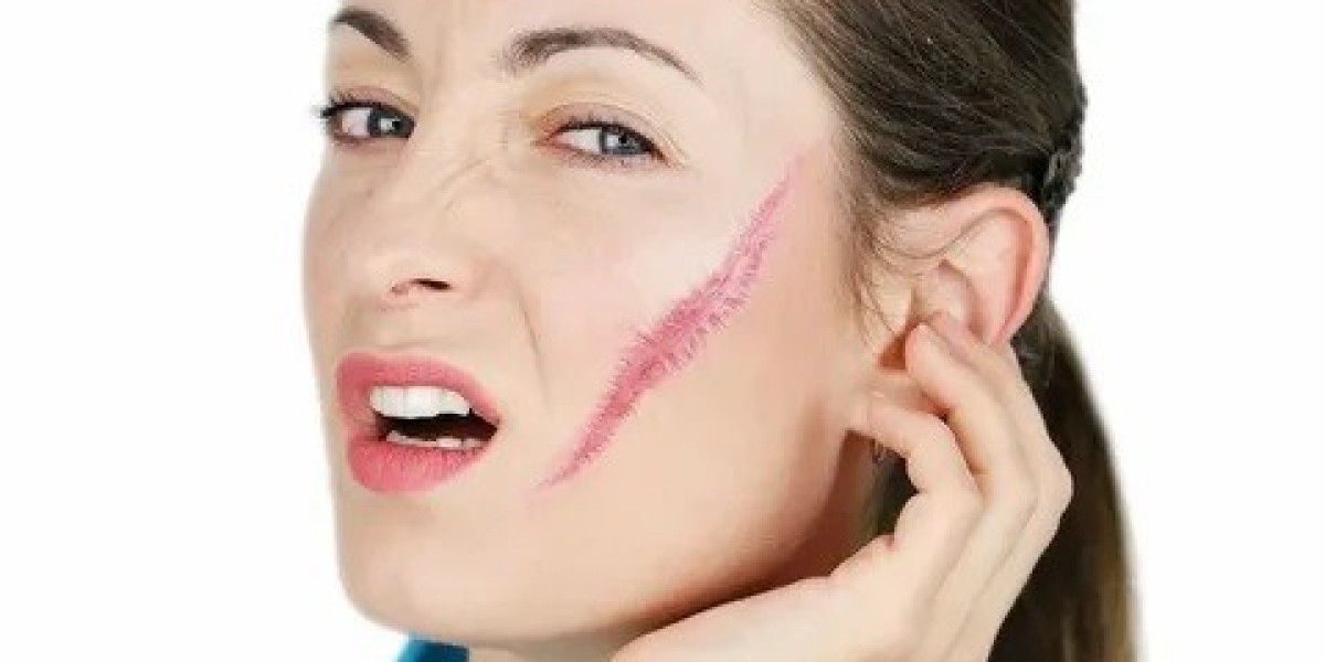 Proven Methods for Facial Scar Correction in Islamabad