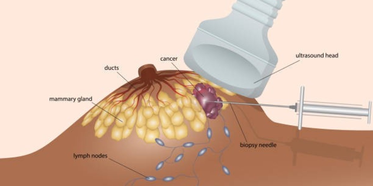 Global Breast Biopsy Devices Market Analysis: Trends, Innovations, and Industry Outlook