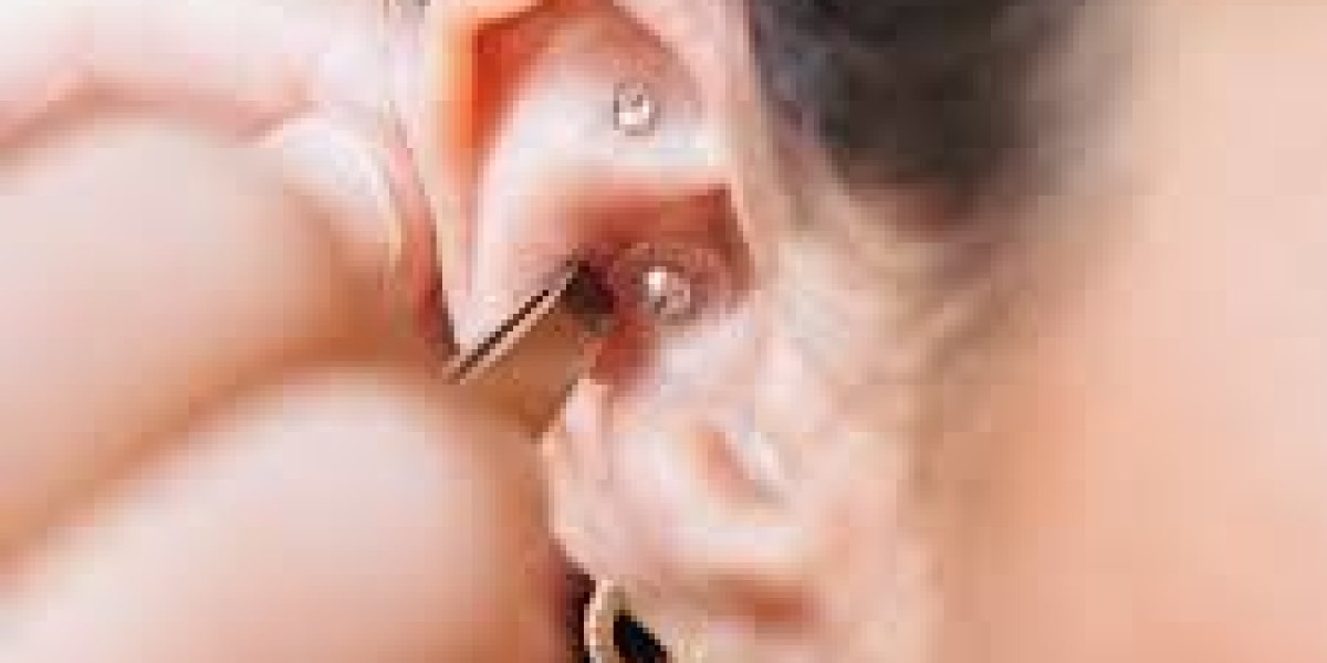 Ear Seeds: A Natural Acupressure Method for Everyday Wellness