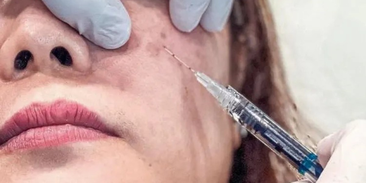 Why Everyone in Dubai Is Obsessed with Teoxane Dermal Fillers Right Now: 7 Powerful Reasons You Need to Know