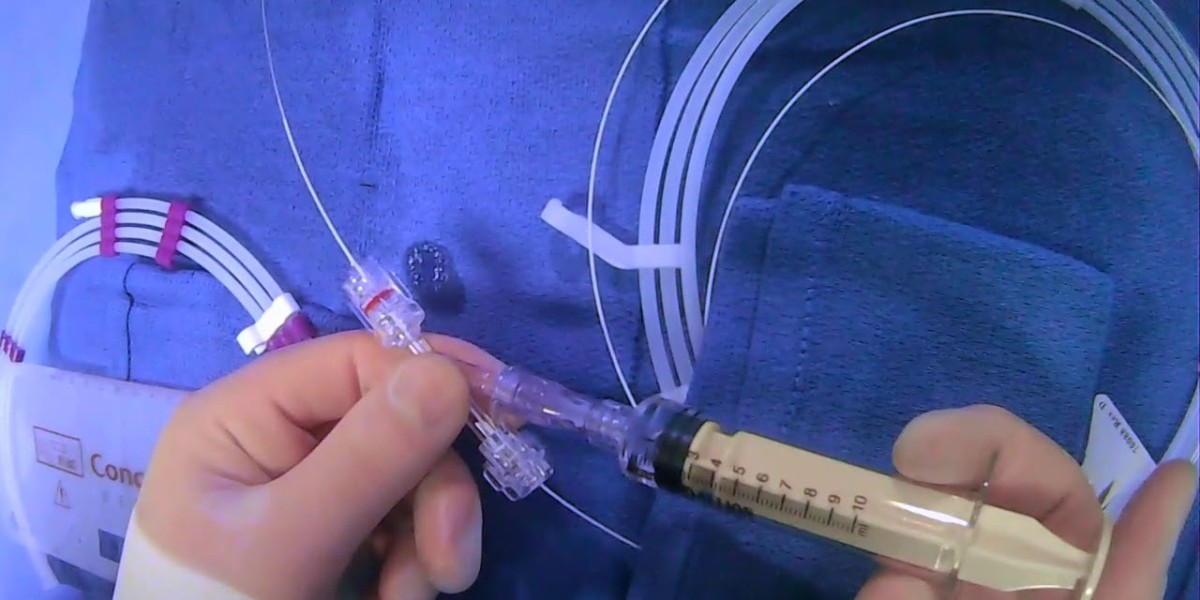 Top 20 Companies in United Kingdom Microcatheter Market 2025: Market Statistics Report