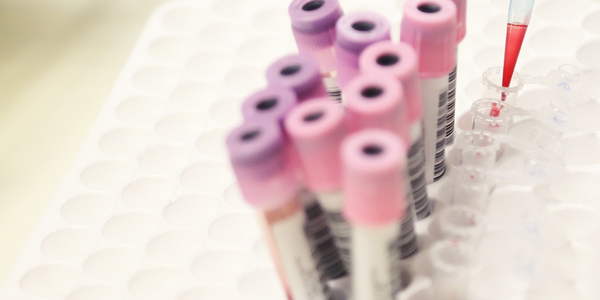 HIV Test in Dubai: Accurate and Hassle-Free Screening