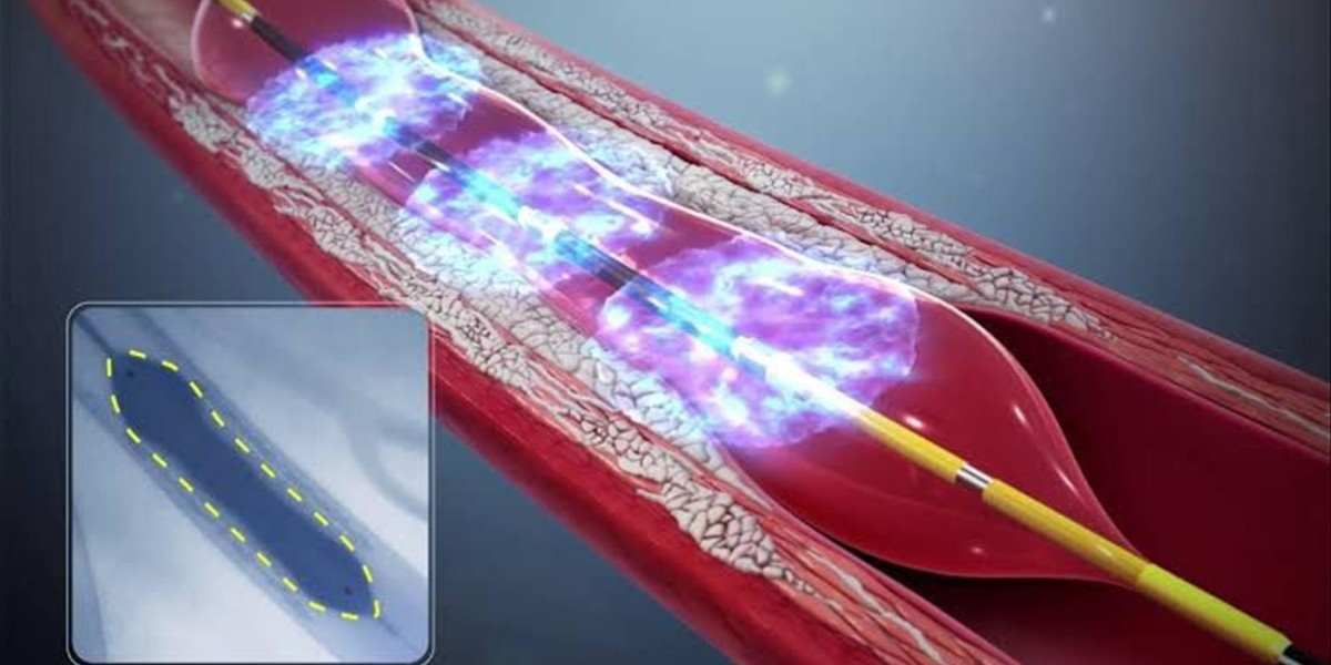 Intravascular Lithotripsy Market Report: Competitive Landscape and Regional Insights