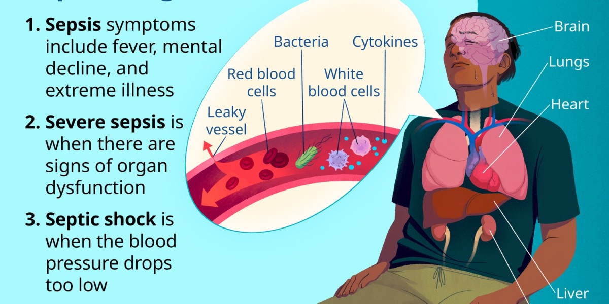 Sepsis Treatment Market Growth, Key Players & Future Opportunities