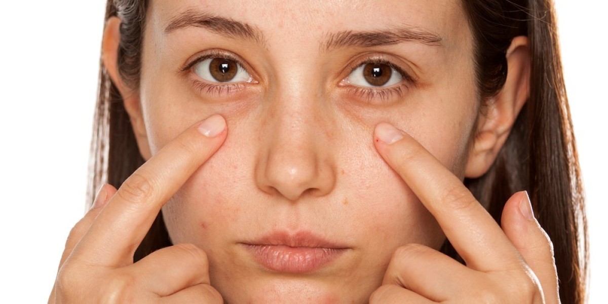 Top Skin Care Procedures for Dark Circles Treatment in Islamabad