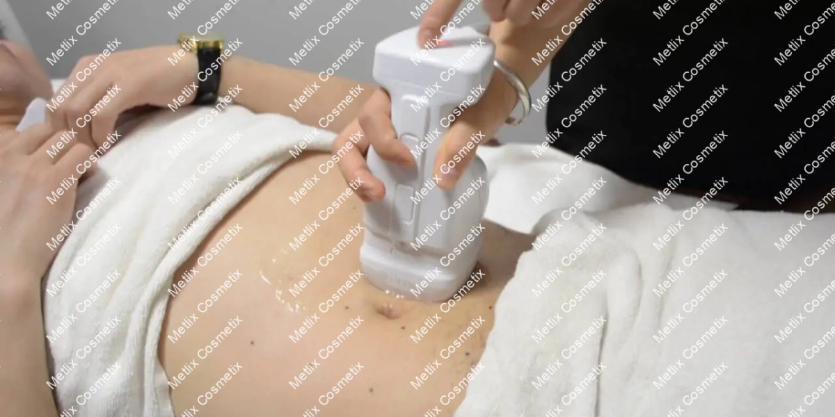 نصائح قبل جلسة علاج ليبوسونيكس في الرياض