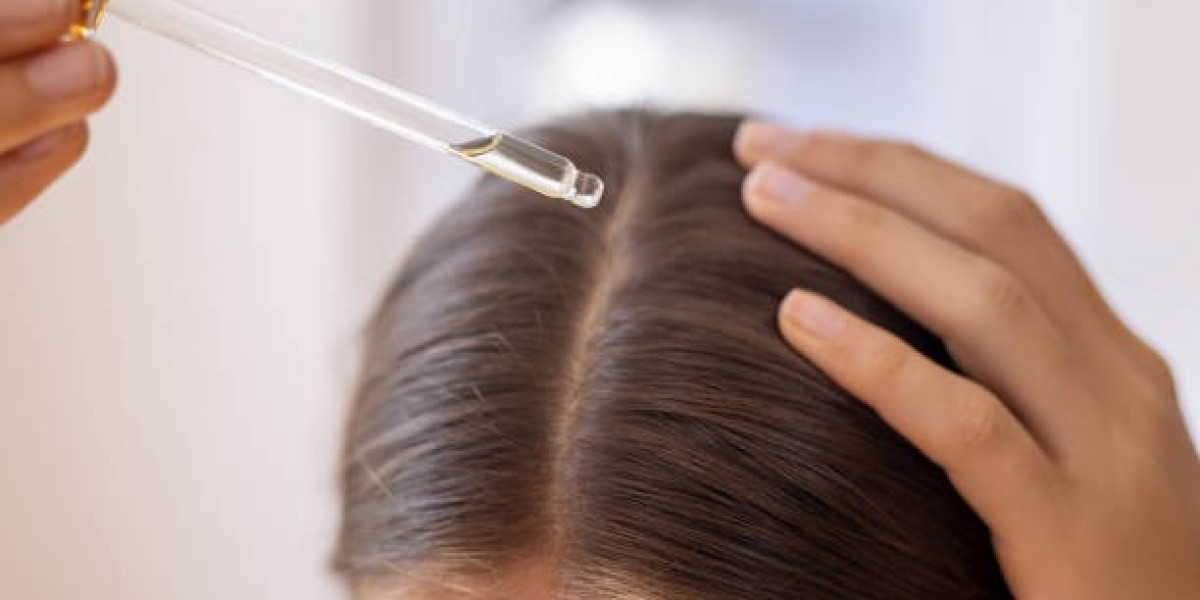 Complete  Guide to Hair Loss Treatment in Islamabad