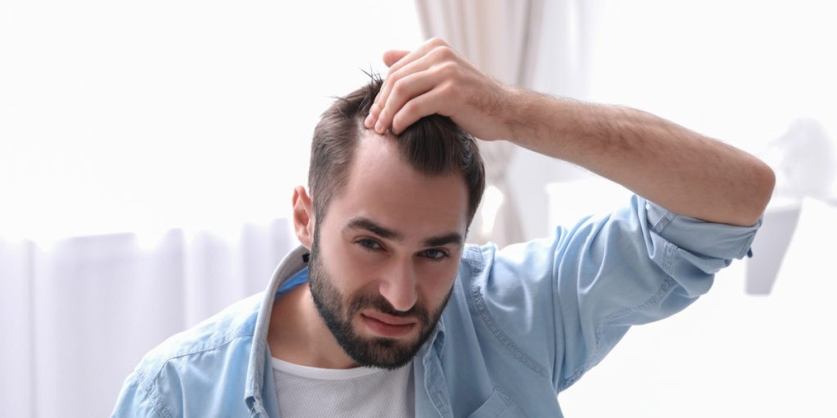 When Is Best PRP Hair Treatment in Dubai Most Effective
