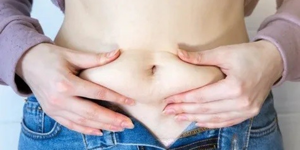 Liposuction in Islamabad: Everything You Should Ask