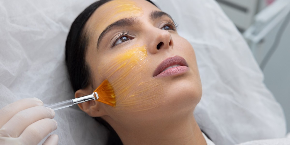 Unlock Radiant Skin With Chemical Peels in Islamabad
