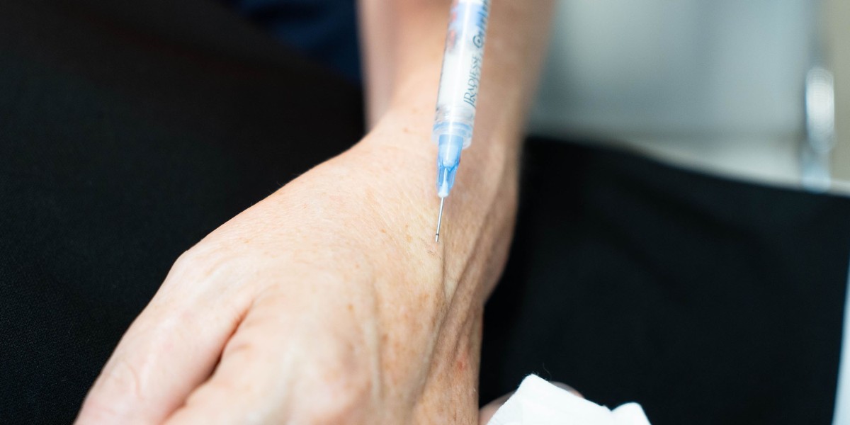 Say Goodbye to Age Spots: Hand Rejuvenation Techniques in Riyadh