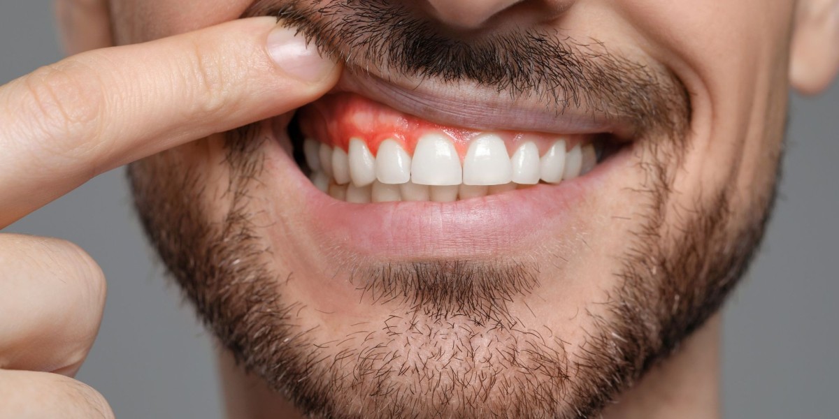 What Counts as Periodontal and Gum Disease Treatment?
