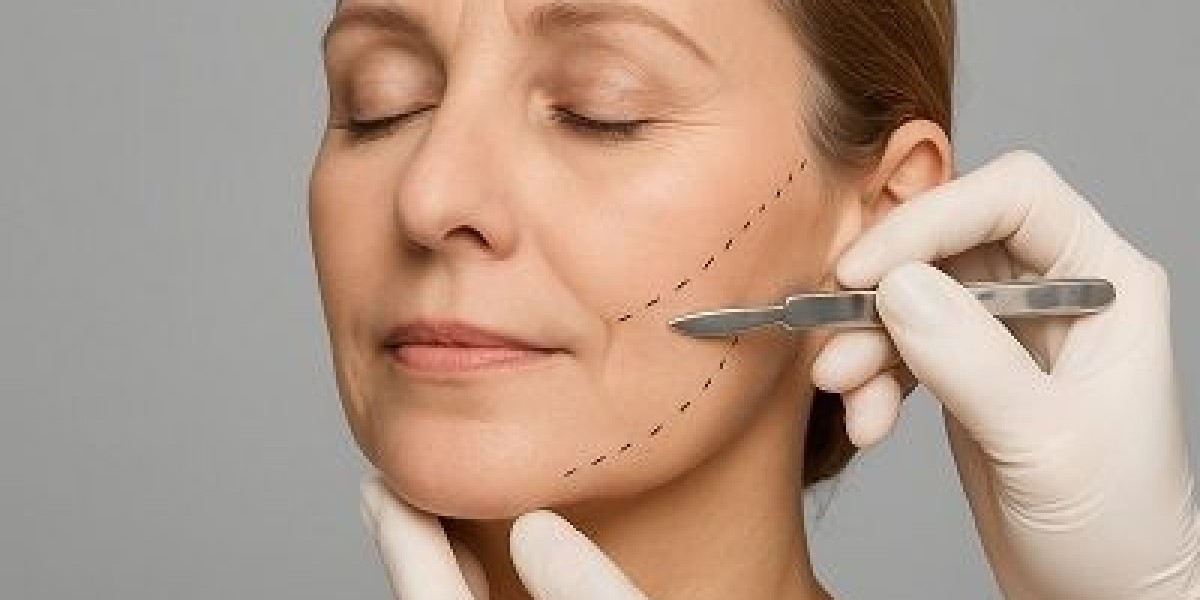 Surgical Excellence in Facelift in Islamabad