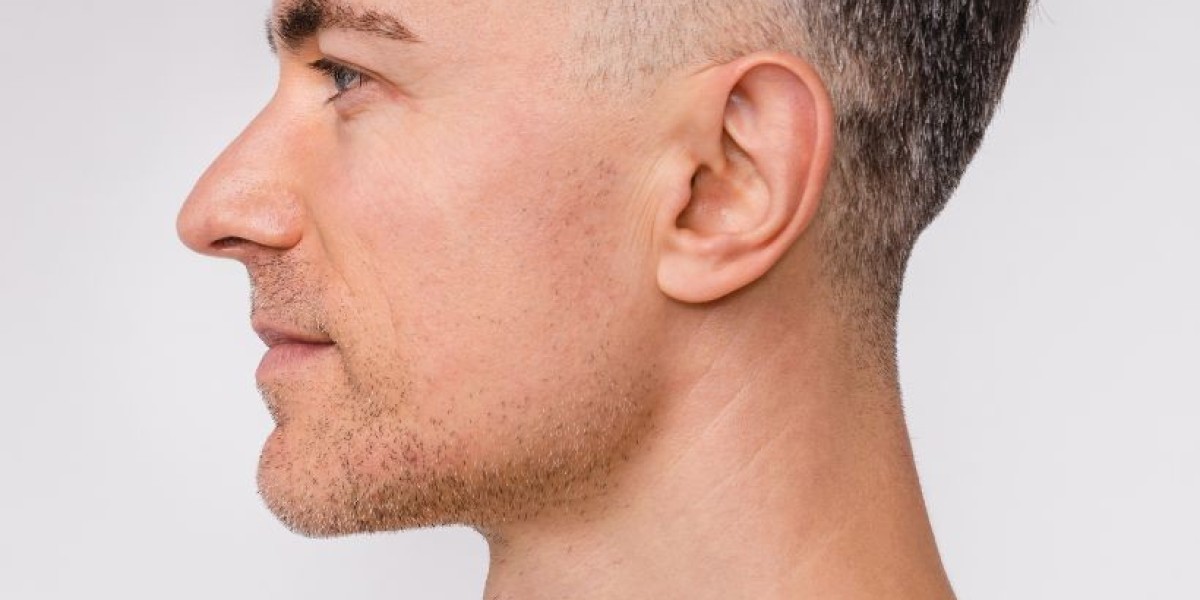 Stronger Jaw, Stronger Presence: Why Dubai Men Are Turning to Dermal Fillers