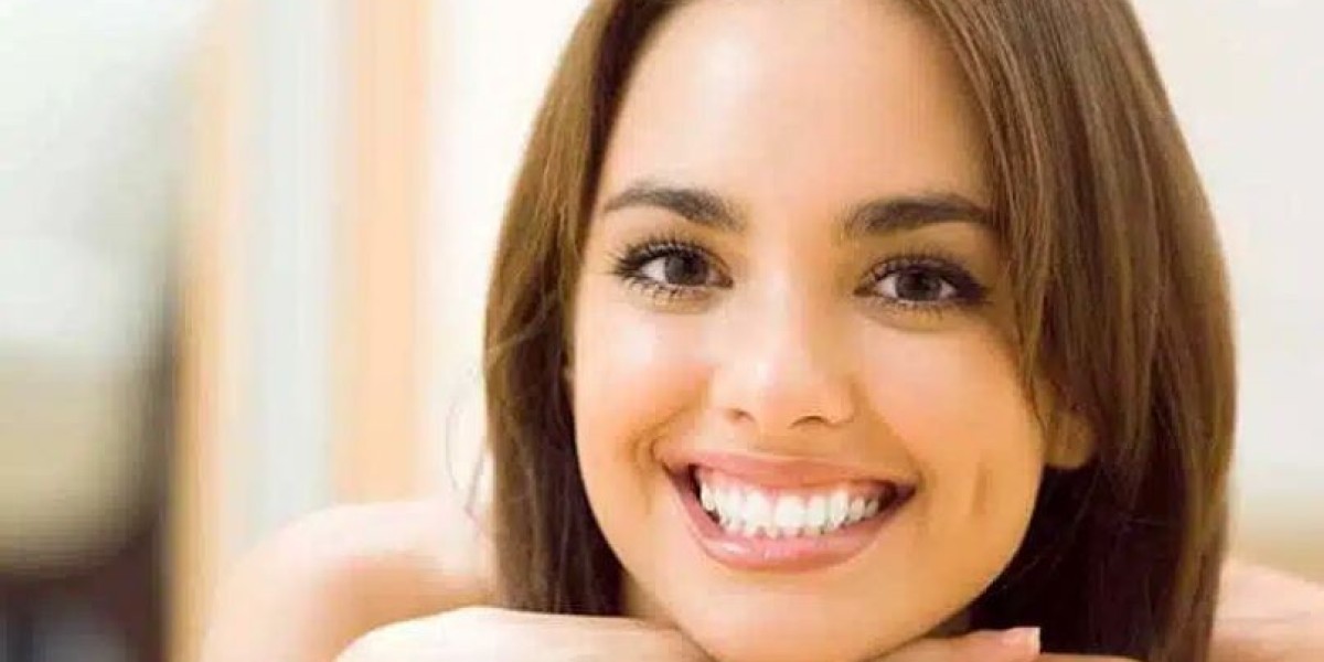 Best Gummy Smile Correction Treatment in Hyderabad | Restore Your Perfect Smile