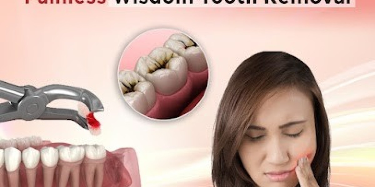 Wisdom Tooth Removal in Hyderabad – Expert Care at FMS Dental
