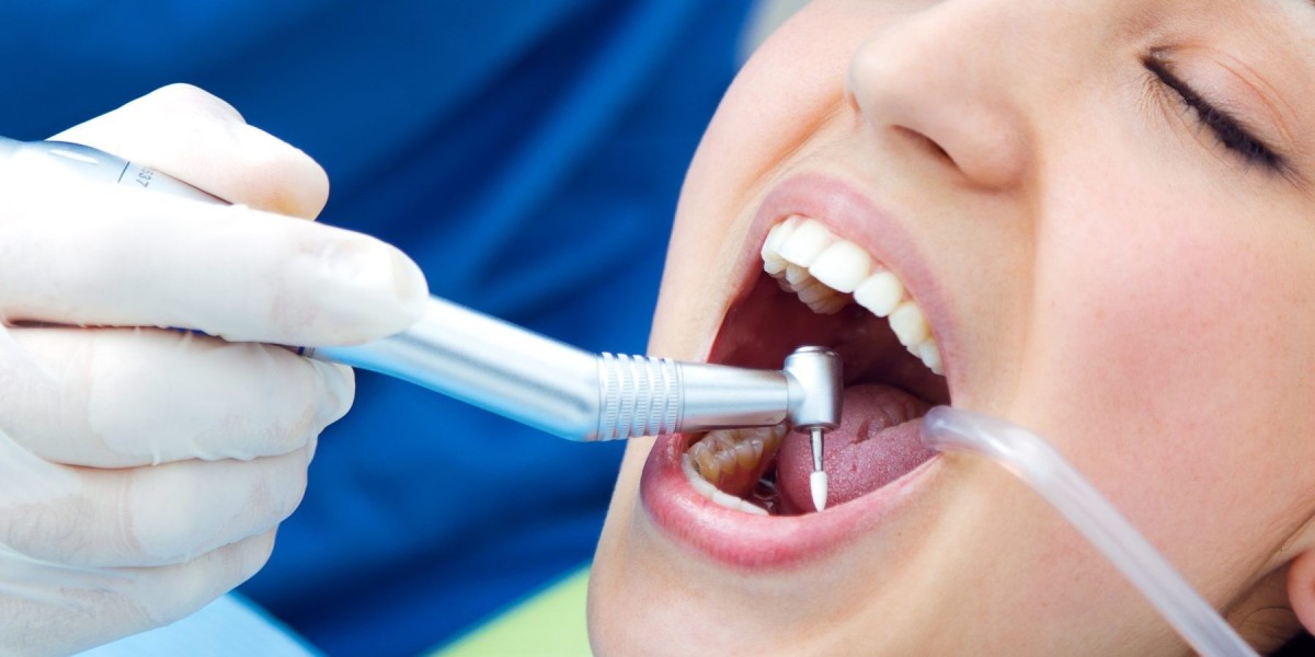 Cheapest Tooth Extraction Why It Matters for Dental Health?