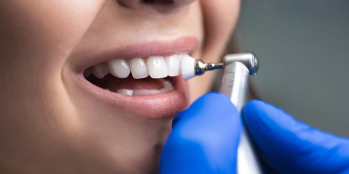 Scaling and Polishing: Why Regular Maintenance is the Best Investment for Your Smile