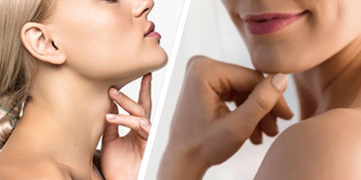 How to Remove Double Chin Without Surgery in Islamabad