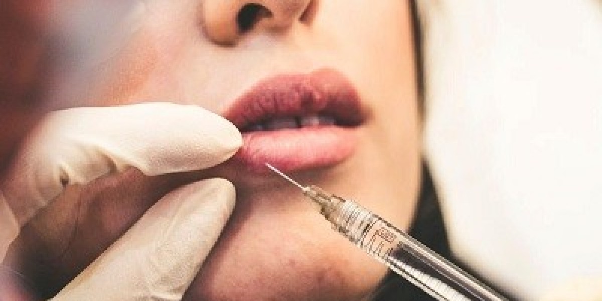Lip Injections in Riyadh Subtle Lip Lift