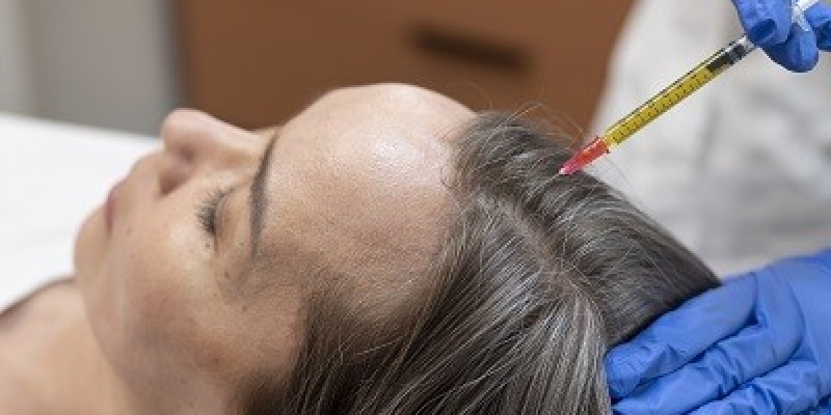 Rejuvenate Your Hairline with Exosomes Hair Therapy in Islamabad