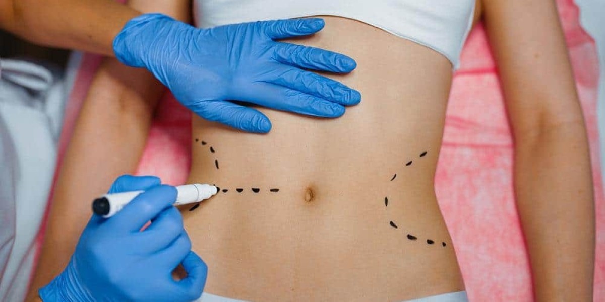 Complications of Bariatric Surgery in Islamabad and Recovery