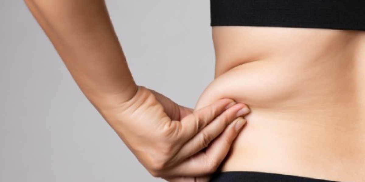 Your Step-by-Step Liposuction Surgery Guide in Dubai