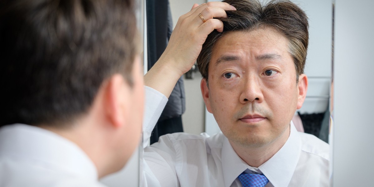 앞머리 라인의 변화를 자연스럽게 관리하는 방법