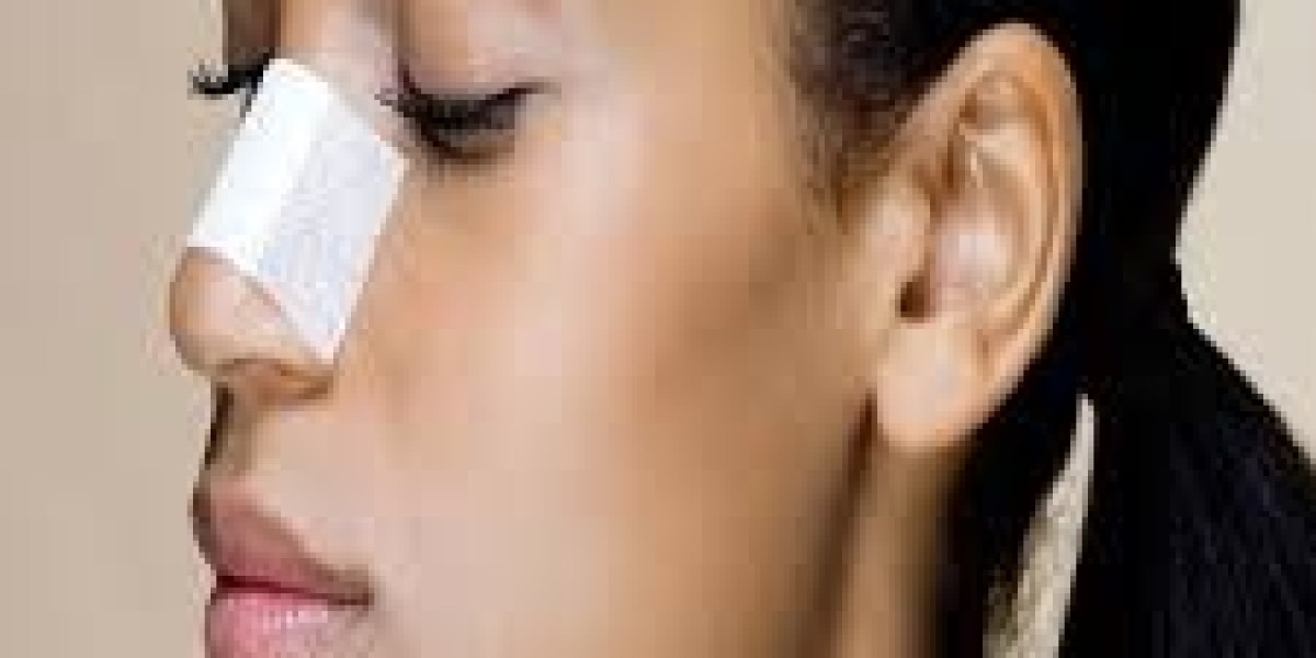 Rhinoplasty in Dubai Swelling and Healing Stages