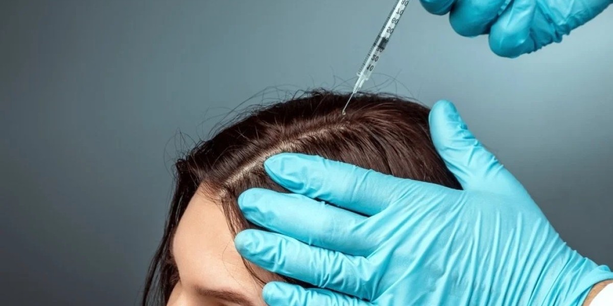 Hair Regeneration Techniques: Stem Cells in Islamabad