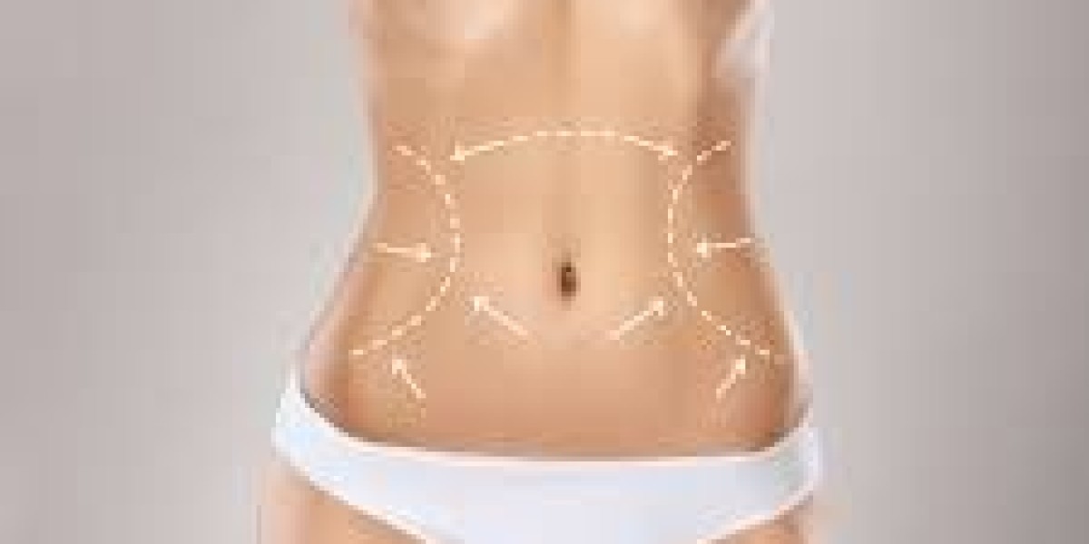 Liposuction Surgery in Dubai Side Effects and Risk Factors Guide