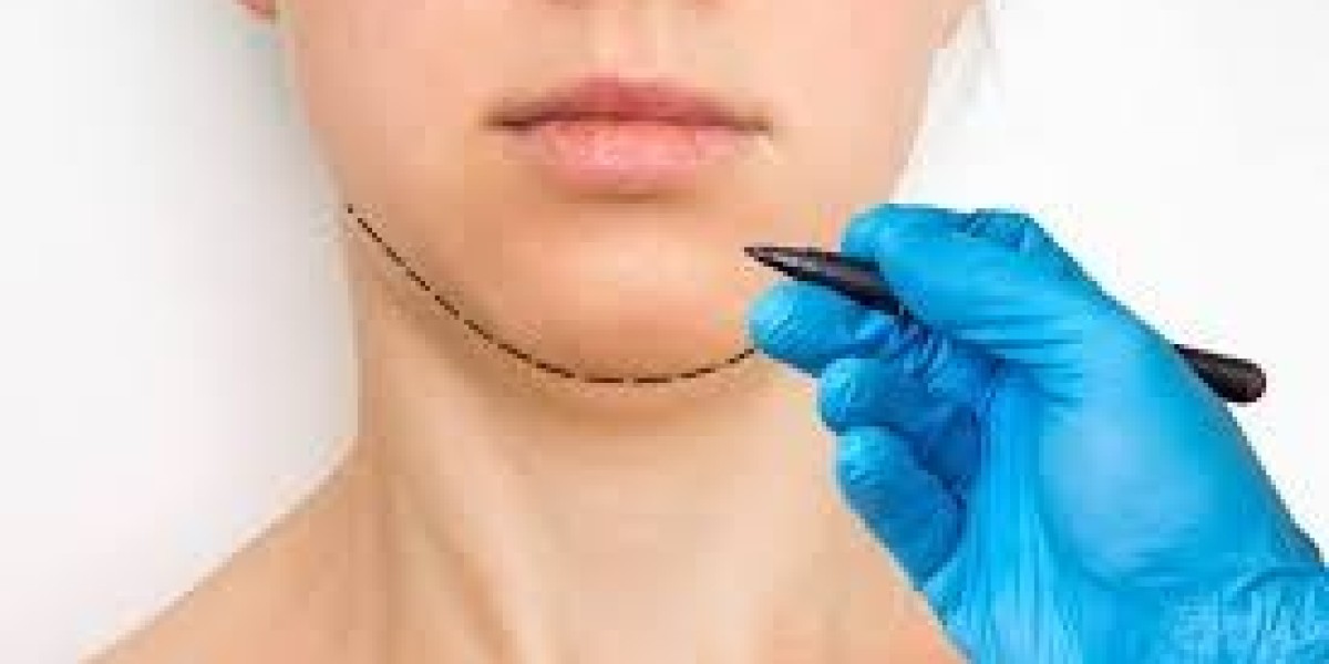 Double Chin Liposuction in Dubai Advanced Fat Removal