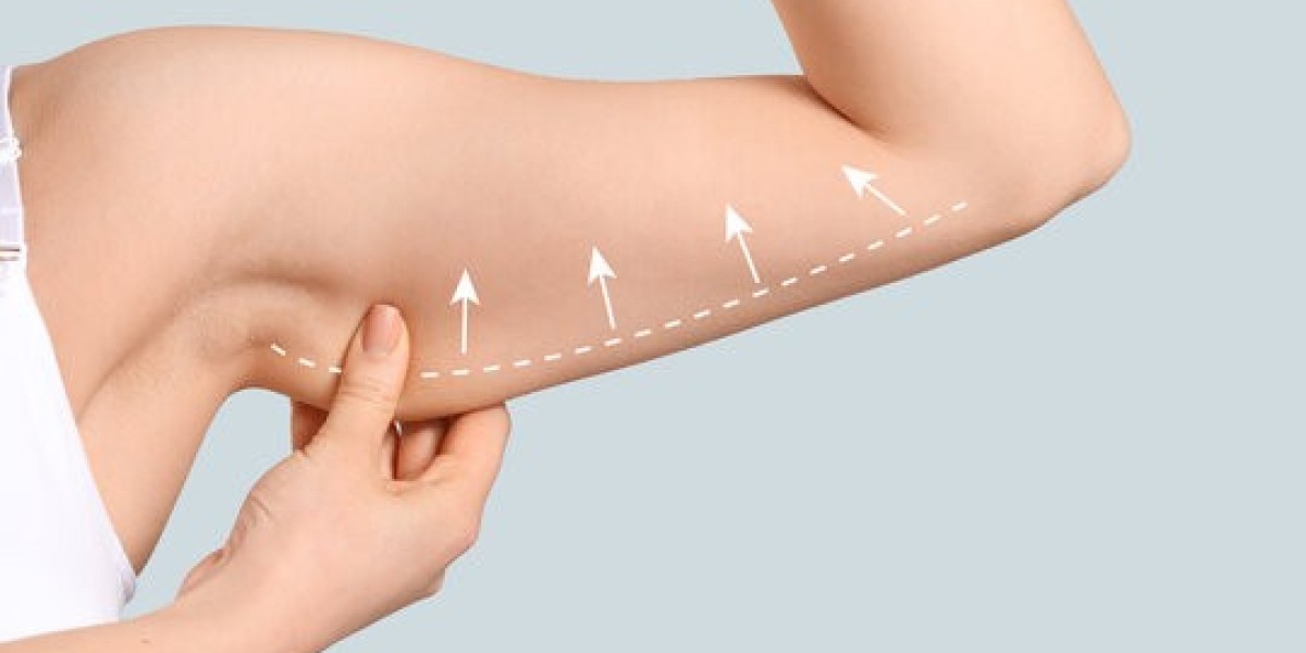 What to Expect During an Arm Lift Surgery