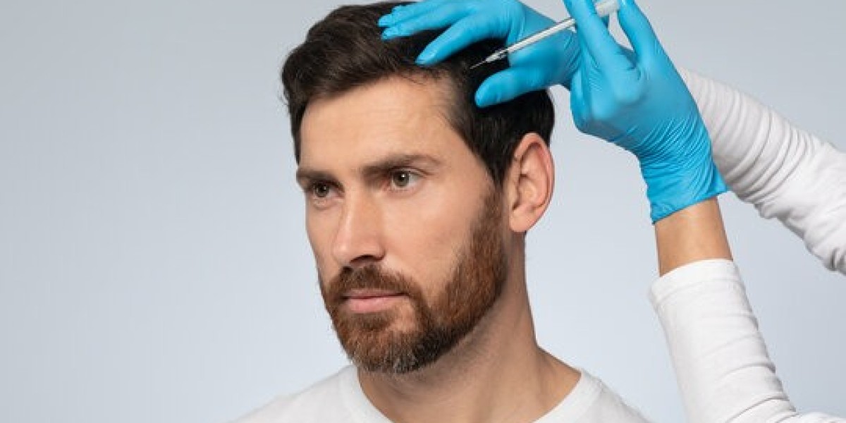 Step-by-Step PRP Hair Treatment Journey for Optimal Results