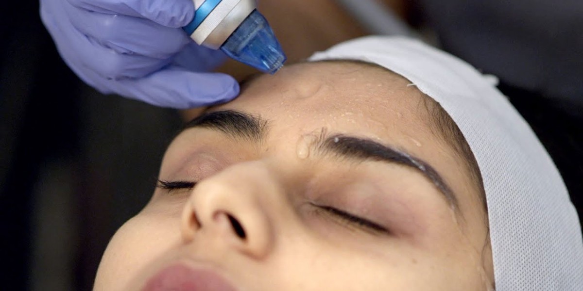 Dermabrasion Results: How Long Does the Transformation Last?