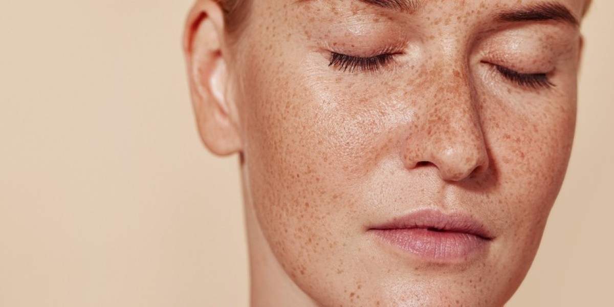 Pigmentation Treatment in Dubai for Sensitive Skin: What You Need to Know