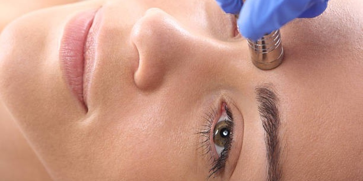 Diamond Peeling in Dubai: A Solution for Acne Scarring