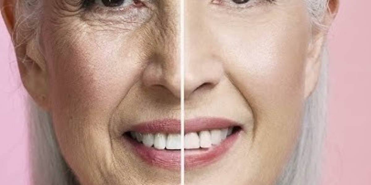 Anti-Aging Treatment in Dubai for Aging Signs