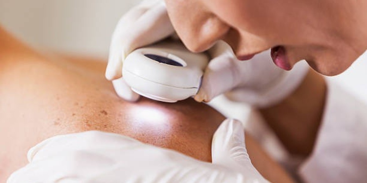 Skin Disease Treatment in Dubai: What Every Resident Must Know