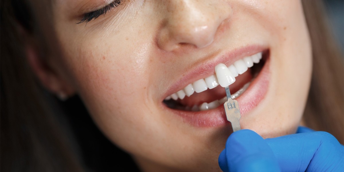 Teeth Whitening Cost in Dubai: Long-Lasting Whitening Solutions