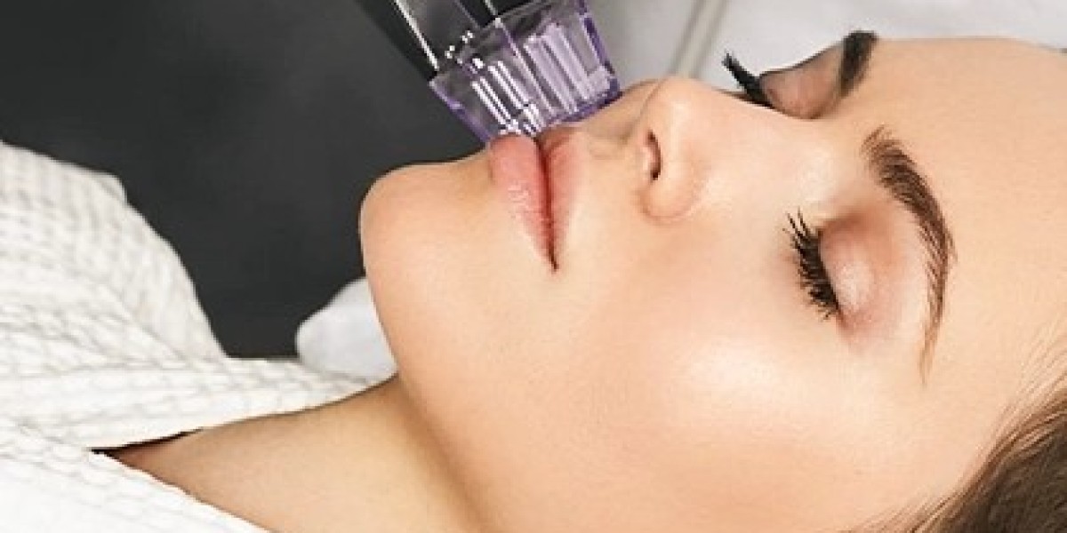 Does Morpheus8 Effectively Tighten the Skin?