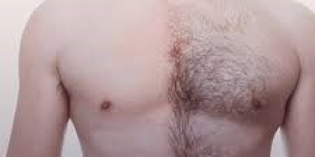 Affordable Options for Body Hair Transplant in Islamabad