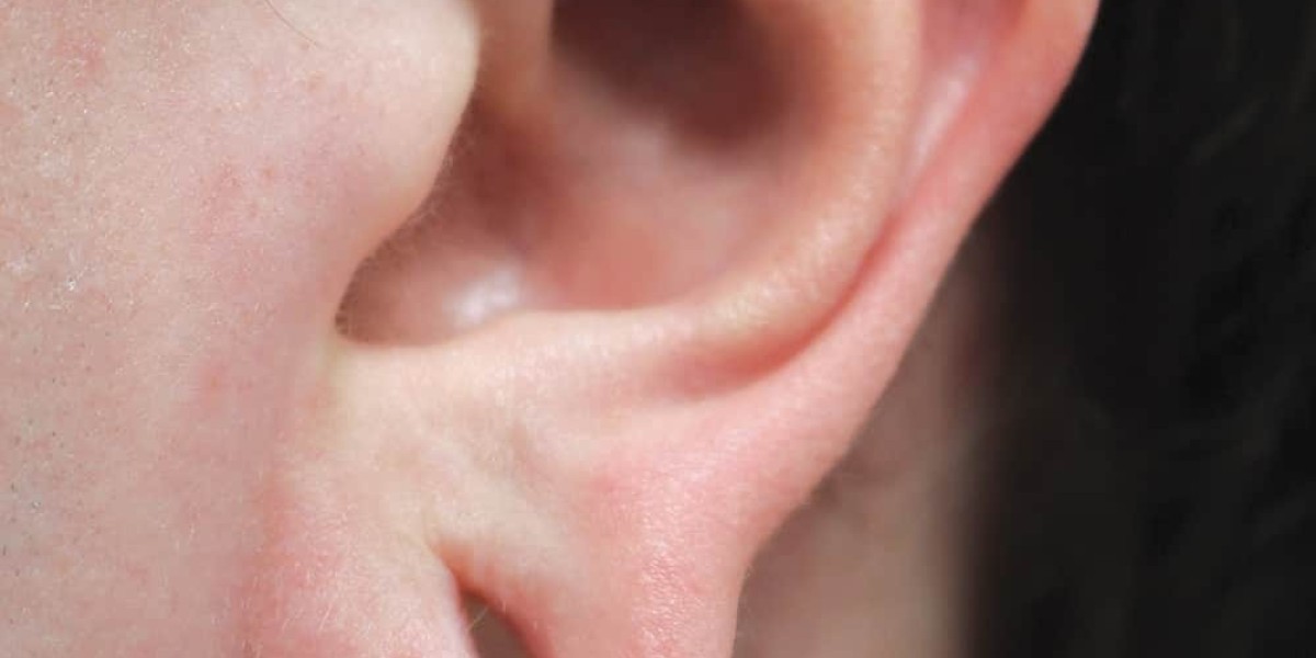 Earlobe Surgery in Dubai Everything About Earlobe Repair Process