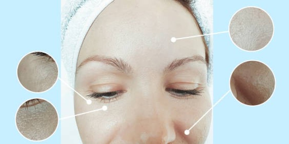 Collagen Stimulation in Dubai: Top Benefits for Youthful Skin