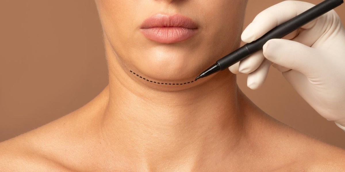 Double Chin Removal in Islamabad: Best Time to Get the Treatment